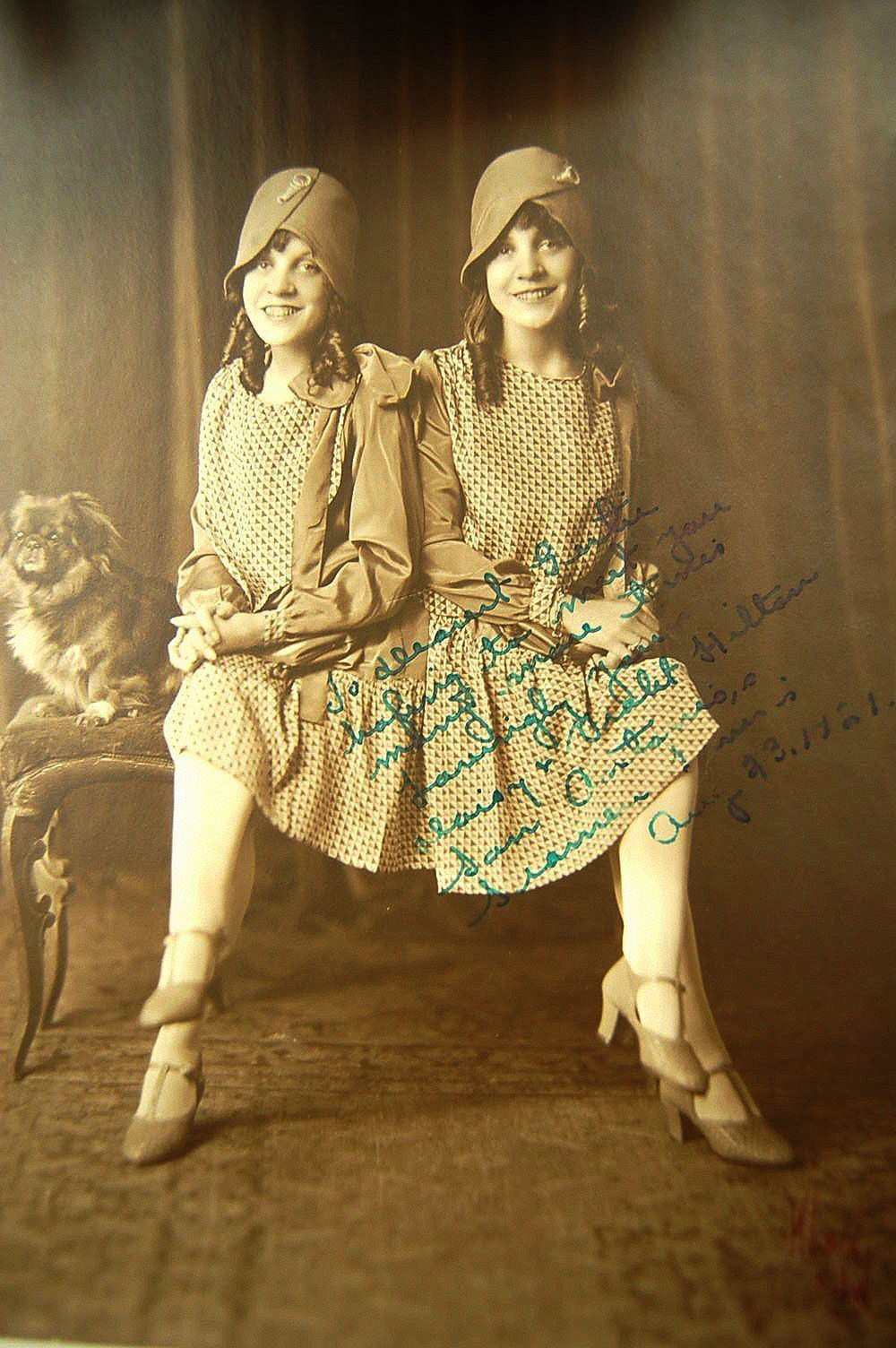 Daisy Hilton y Violet Hilton